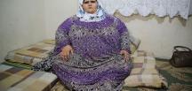 Suriyeli genç kız tedavi olamayınca 350 kiloya çıktı