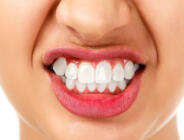 Diş Sağlığı Konusunda Uzmanlar Uyarıyor?